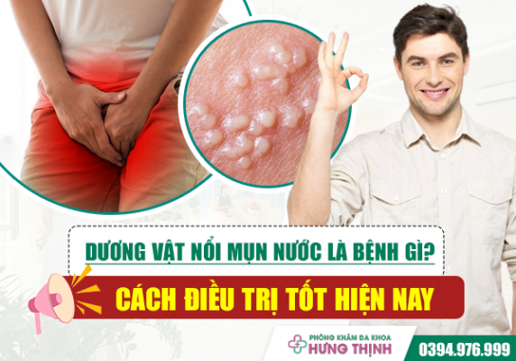 Dương vật nổi mụn nước là bệnh gì? Cách điều trị tốt hiện nay