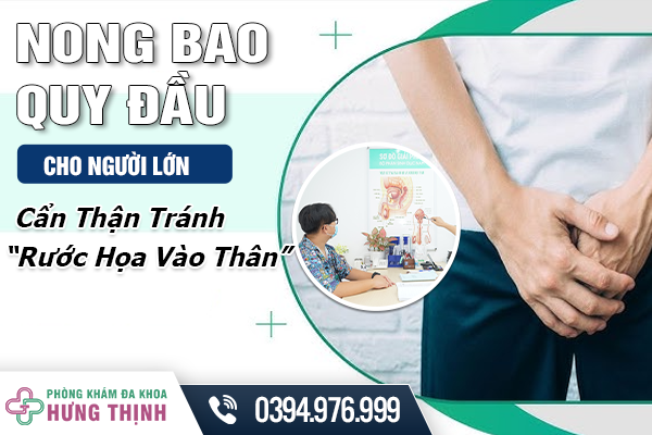 Nong Bao Quy Đầu Cho Người Lớn - Cẩn Thận Tránh “Rước Họa Vào Thân”