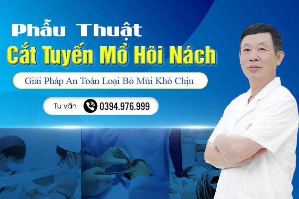 Phẫu Thuật Cắt Tuyến Mồ Hôi Nách: Giải Pháp An Toàn Loại Bỏ Mùi Khó Chịu