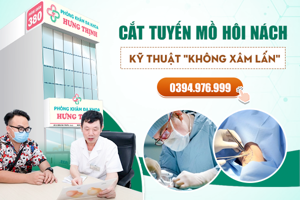 Phòng Khám Cắt Tuyến Mồ Hôi Nách Chất Lượng Với Kỹ Thuật “Không Xâm Lấn” Hiện Đại