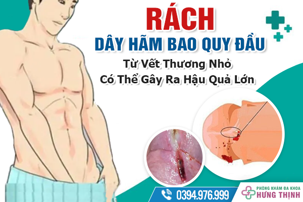 Rách Dây Hãm Bao Quy Đầu: Từ Vết Thương Nhỏ Có Thể Gây Ra Hậu Quả Lớn