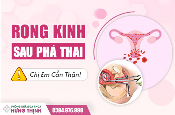 Rong Kinh Sau Phá Thai: Chị Em Cẩn Thận!