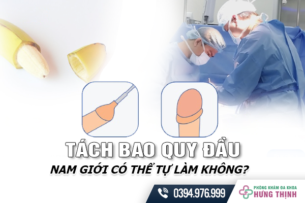 Tách Bao Quy Đầu - Nam Giới Có Thể Tự Làm Không?