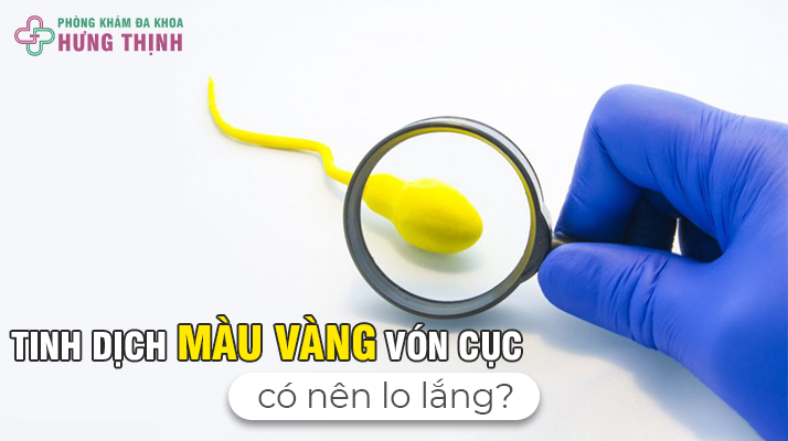 Tinh Dịch Màu Vàng Vón Cục Có Nên Lo Lắng?