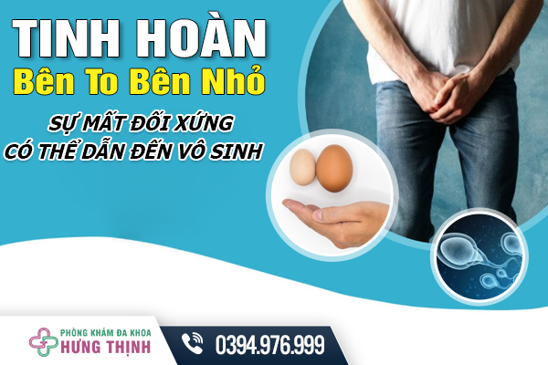 Tinh Hoàn Bên To Bên Nhỏ: Sự Mất Đối Xứng Có Thể Dẫn Đến Vô Sinh