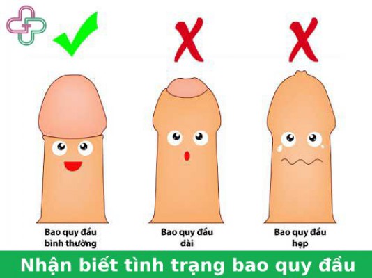 Hẹp bao quy đầu: Nguyên nhân, triệu chứng và cách điều trị 