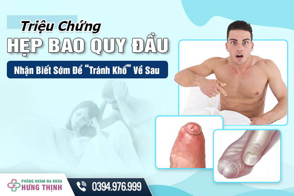 Triệu Chứng Hẹp Bao Quy Đầu: Nhận Biết Sớm Để “Tránh Khổ” Về Sau