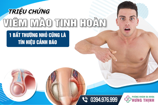 Triệu Chứng Viêm Mào Tinh Hoàn - 1 Bất Thường Nhỏ Cũng Là Tín Hiệu Cảnh Báo