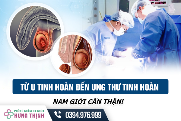 Từ U Tinh Hoàn Đến Ung Thư Tinh Hoàn: Nam Giới Cẩn Thận!