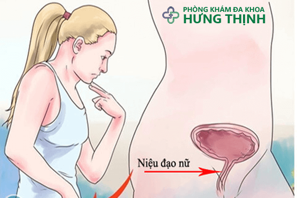 Phương pháp chữa niệu đạo an toàn và hiệu quả