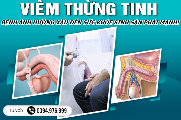 Viêm Thừng Tinh - Bệnh Ảnh Hưởng Xấu Đến Sức Khỏe Sinh Sản Phái Mạnh!