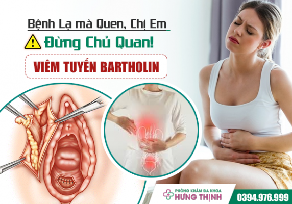 Viêm Tuyến Bartholin - Bệnh Lạ Mà Quen, Chị Em Đừng Chủ Quan!