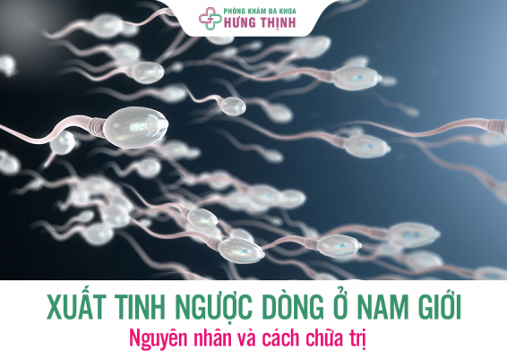 Xuất tinh ngược dòng- nỗi ám ảnh của cánh mày râu