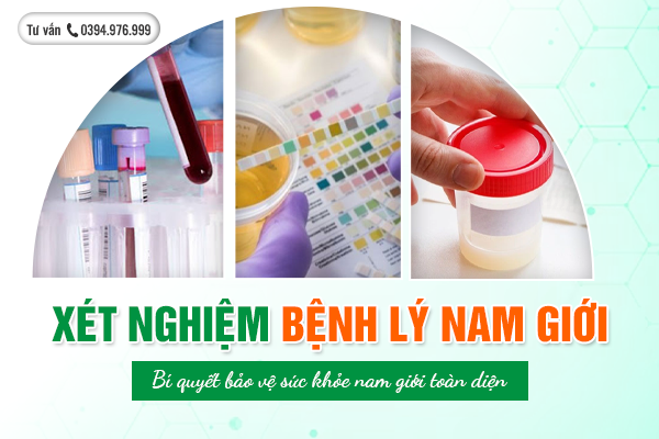 Xét nghiệm bệnh nam giới - Bí quyết bảo vệ sức khỏe nam giới toàn diện!