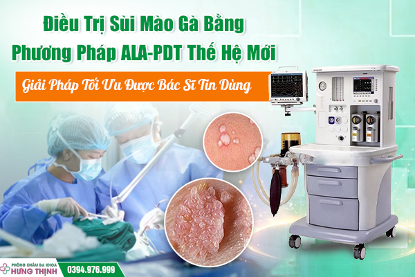 Điều Trị Sùi Mào Gà Bằng Phương Pháp ALA-PDT Thế Hệ Mới– Giải Pháp Tối Ưu Được Bác Sĩ Tin DùngXem ngay để biết lý do trong bài viết dưới đây. 