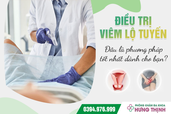 Điều trị viêm lộ tuyến: Đâu là phương pháp tốt nhất dành cho bạn?