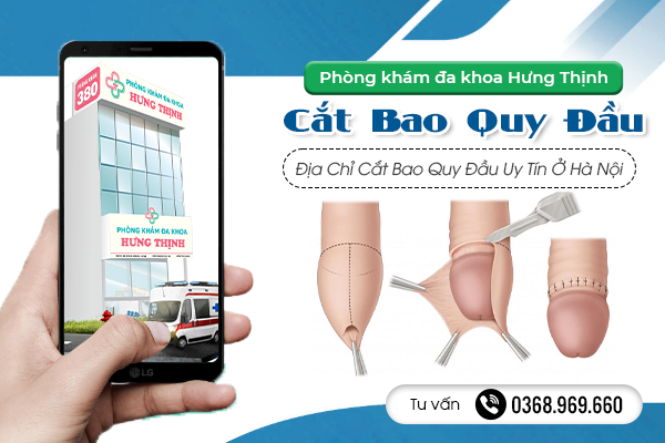 PHÒNG KHÁM ĐA KHOA HƯNG THỊNH - ĐỊA CHỈ CẮT BAO QUY ĐẦU UY TÍN TẠI HÀ NỘI 