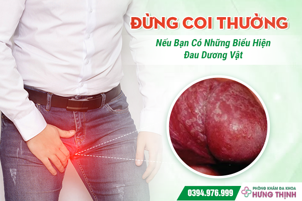Đừng Coi Thường Nếu Bạn Có Những Biểu Hiện Đau Dương Vật