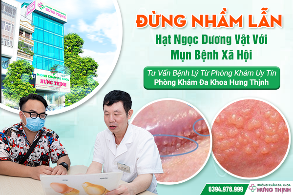 Đừng Nhầm Lẫn Hạt Ngọc Dương Vật Với Mụn Bệnh Xã Hội: Tư Vấn Bệnh Lý Từ Phòng Khám Uy Tín –  Phòng Khám Đa Khoa Hưng Thịnh