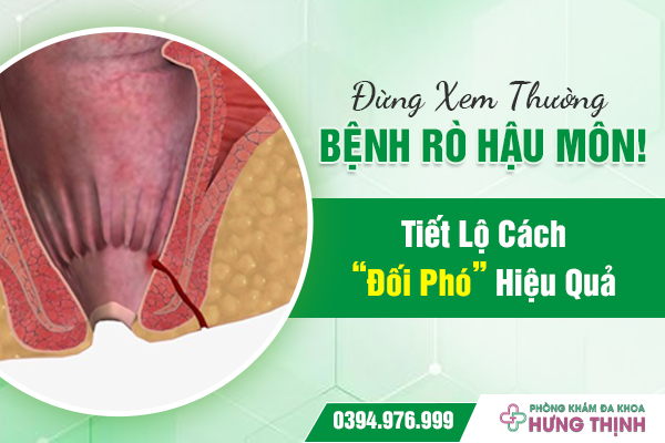 Đừng Xem Thường Bệnh Rò Hậu Môn ! Tiết Lộ Cách “Đối Phó” Hiệu Quả