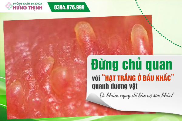 Đừng chủ quan với “hạt trắng ở đầu khấc” quanh dương vật: Đi khám ngay để bảo vệ sức khỏe!