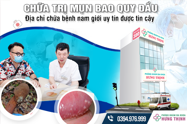 Chữa trị mụn bao quy đầu: Địa chỉ khám bệnh nam giới uy tín được tin cậy